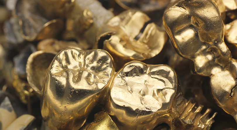 Verschiedenes Zahngold 